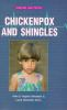 Chickenpox_and_shingles