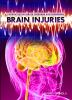Brain_injuries